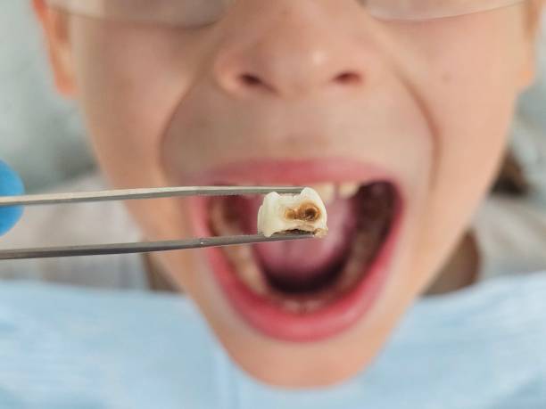 Best Same-Day Emergency Dental Services in Thomasville, GA