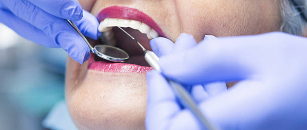 Best Emergency Wisdom Teeth Removal in Thomasville, GA
